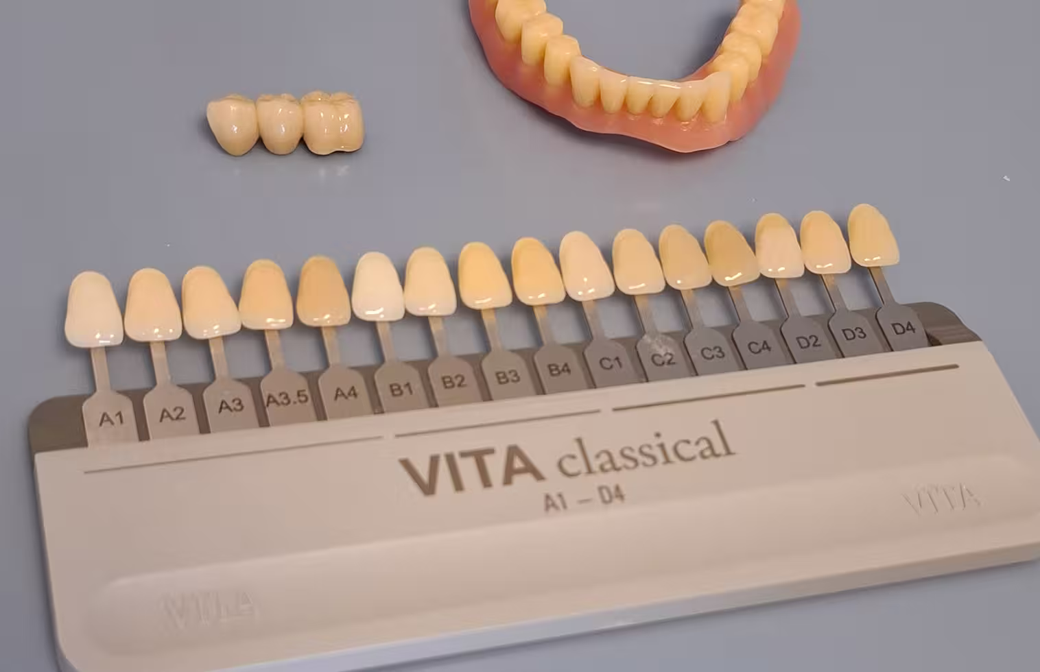 implant-dentaire-amovible implant dentaire amovible